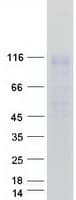 Human ENPP1 Protein (Recombinant Myc-DDK (Flag))