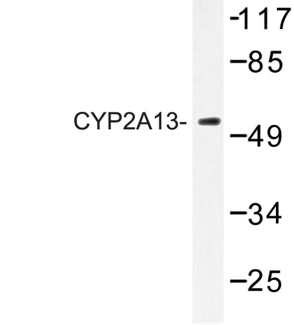 CYP2A13 Antibody (Asn338)