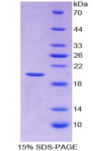 Rabbit IL-1B / IL-1 Beta Protein (Recombinant His-T7)
