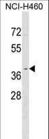 OR2Y1 Antibody (aa244-271)