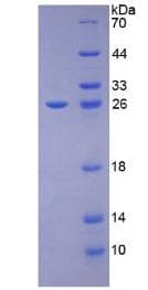 Rat KITLG / SCF Protein (Recombinant His)