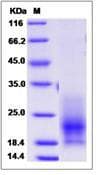 Monkey-Cynomolgus CD63 Protein (Recombinant His,C-terminus)