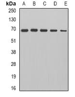 Polyclonal Rabbit anti-Human DLAT / PDC-E2 Antibody (IF, WB)