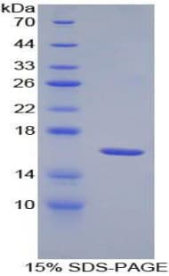 Mouse CDw218a / IL18R1 Protein (Recombinant His)