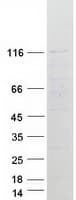 Human MIB1 Protein (Recombinant Myc-DDK (Flag))