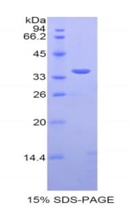 Human SULT1A1 / Sulfotransferase 1A1 Protein (Recombinant His)
