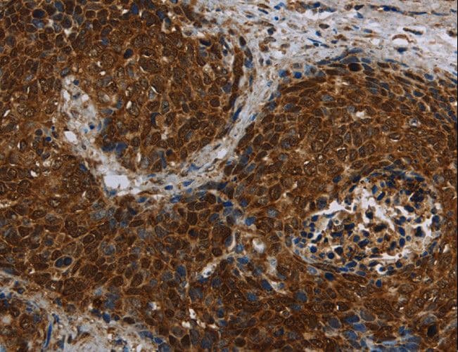 Polyclonal Rabbit anti-Human LASS5 Antibody (IHC)