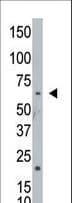 NEK8 Antibody (aa65-95)