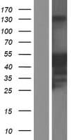 JSRP1 Protein (Over-Expression Lysate Myc-DDK (Flag))