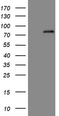 ALDP / ABCD1 Antibody (aa508-745, clone OTI3A1)