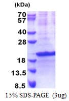 Human SIVA1 / SIVA Protein (Recombinant His)
