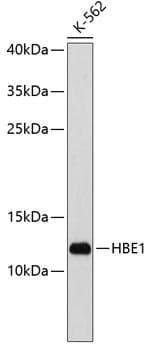 Polyclonal Rabbit anti-Human HBE1 / Hemoglobin Epsilon 1 Antibody (WB)