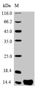 Human PTMA / Prothymosin Alpha Protein (Recombinant 6His, N-terminus)