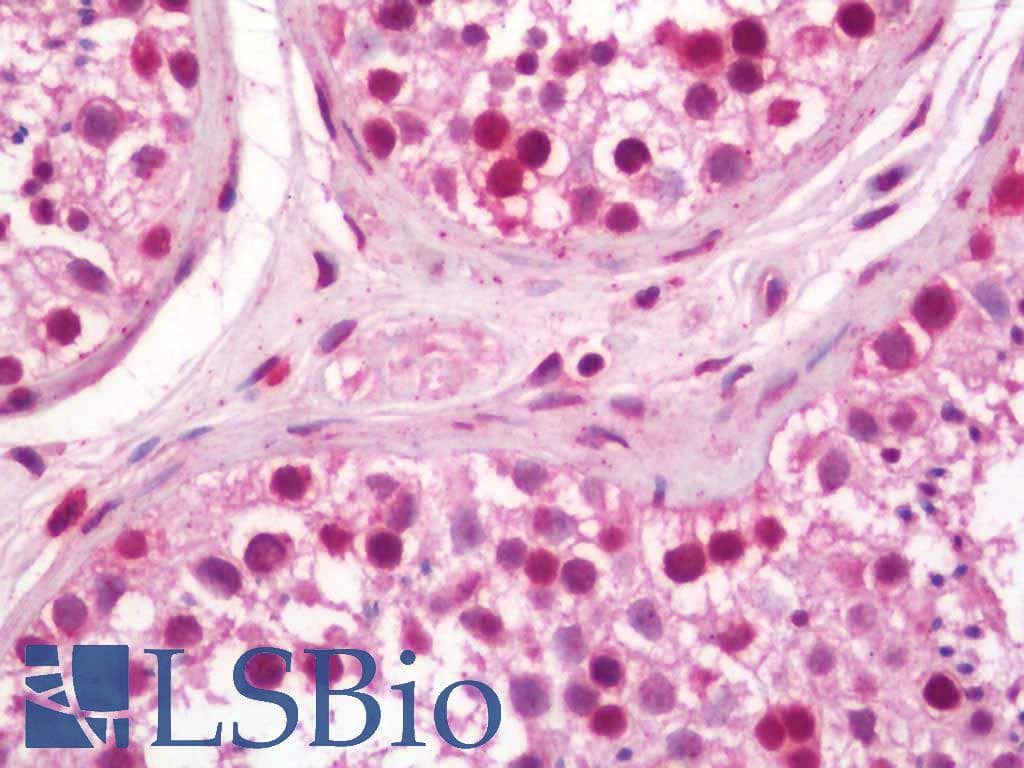 IHC-plus™ E2F5 Antibody (aa93-142)