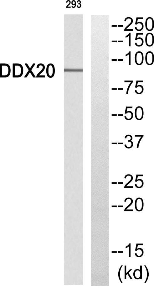 Polyclonal Rabbit anti-Human DDX20 / GEMIN3 Antibody (WB)