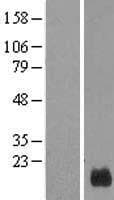 Human GUSBP5 Protein (Over-Expression Lysate Myc-DDK (Flag))