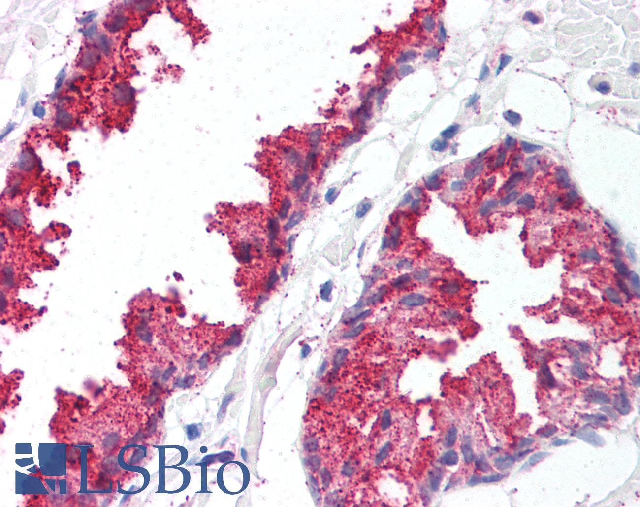 IHC-plus™ BACE1 / BACE Antibody (C-Terminus)