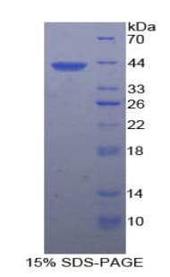 Rat CXCL4 / PF4 Protein (Recombinant His-GST)