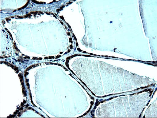 ZFAND3 / TEX27 Antibody (clone OTI1C5)