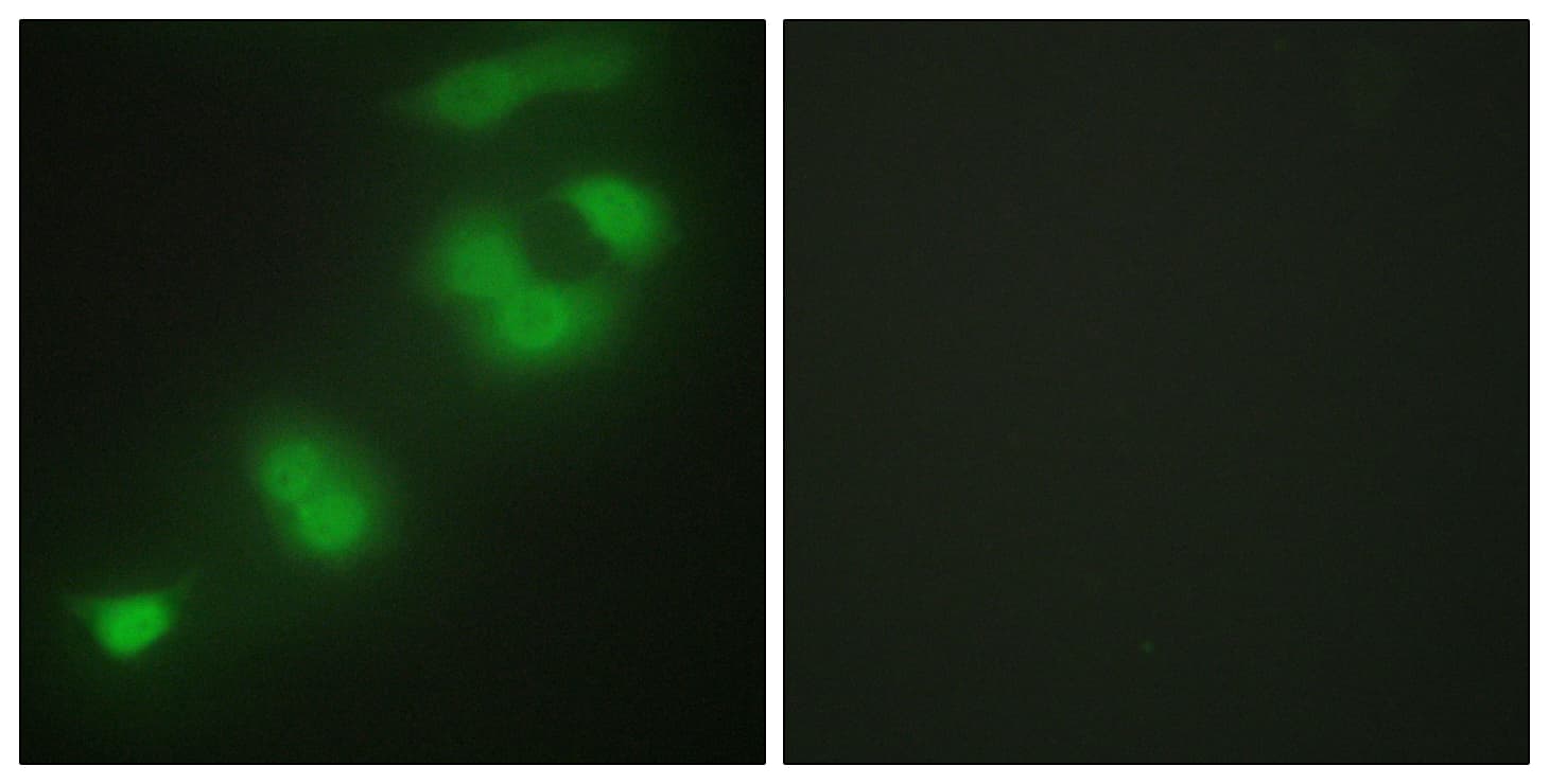 CREBZF / Zhangfei Antibody (aa221-270)