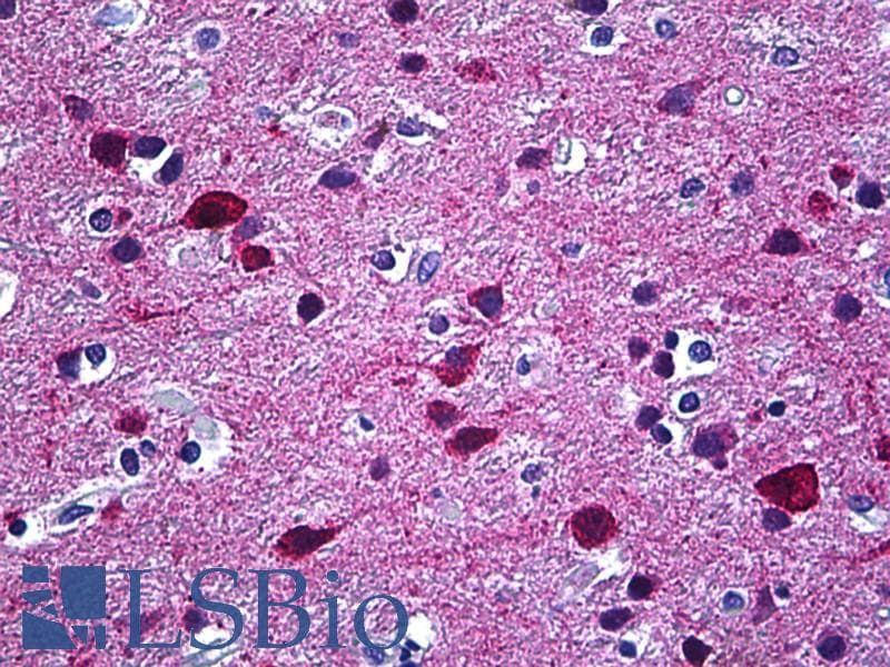 IHC-plus™ STXBP1 / MUNC18-1 Antibody (aa279-328)