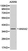 Polyclonal Rabbit anti-Human ANXA2 / Annexin A2 Antibody (IHC, WB)