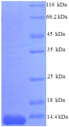 Mouse CCL7 / MCP3 Protein (Recombinant His)