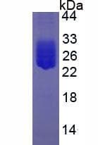 Rat IL6 / Interleukin 6 Protein (Recombinant His, N-Terminal)