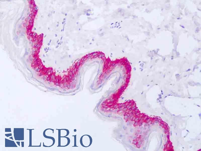 KRT14 / CK14 / Cytokeratin 14 Antibody (C-Terminus, FITC)
