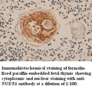 Polyclonal Rabbit anti-Human NUDT6 Antibody (C-Terminus, IHC)