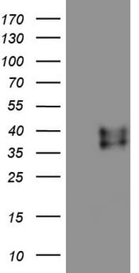 RSPO3 Antibody (aa22-272, clone OTI3A9)