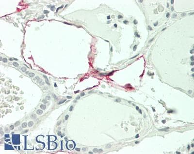 IHC-plus™ Monoclonal Mouse anti-Human NT5E / eNT / CD73 Antibody (clone 45M4F9, Azide-free, aa169-324, IHC, WB)