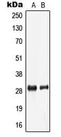 LDLRAD2 Antibody (Internal)