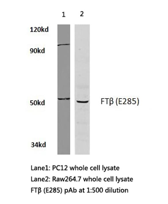 FNTB Antibody (Glu285)