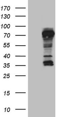 CD30 Antibody (aa19-379, clone OTI3A2)