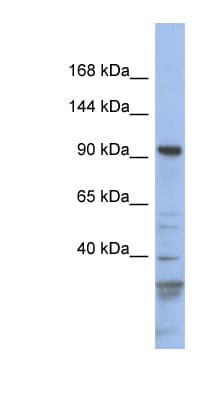 MYO1C Antibody (aa143-192)
