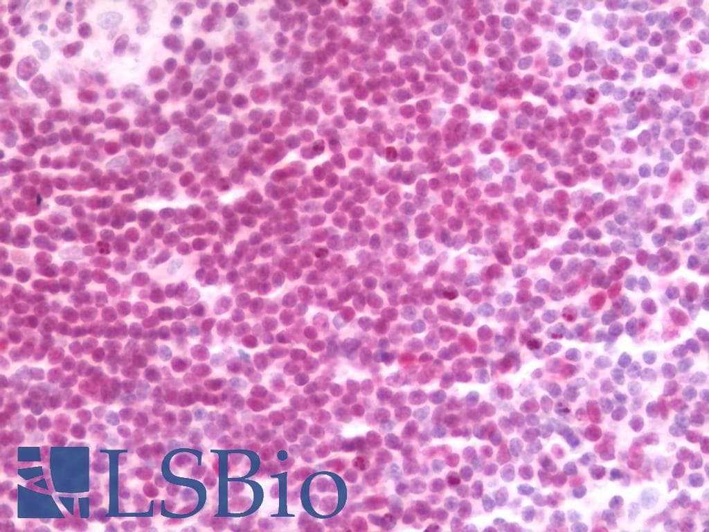 IHC-plus™ IFI16 Antibody (clone 2E3)