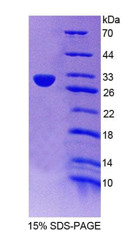 Mouse AURKC / Aurora C Protein (Recombinant His-T7)