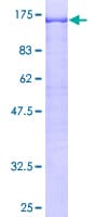 Human COL3A1 / Collagen III Protein (Recombinant GST)