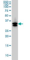 M-PST / STM Antibody (clone 1B10)