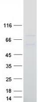 Human BIRC3 / cIAP2 Protein (Recombinant Myc-DDK (Flag))