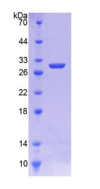 Rat HMG-CoA Reductase / HMGCR Protein (Recombinant His-T7)
