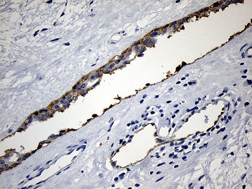 PIKFYVE / PIP5K Antibody (clone OTI1D2)