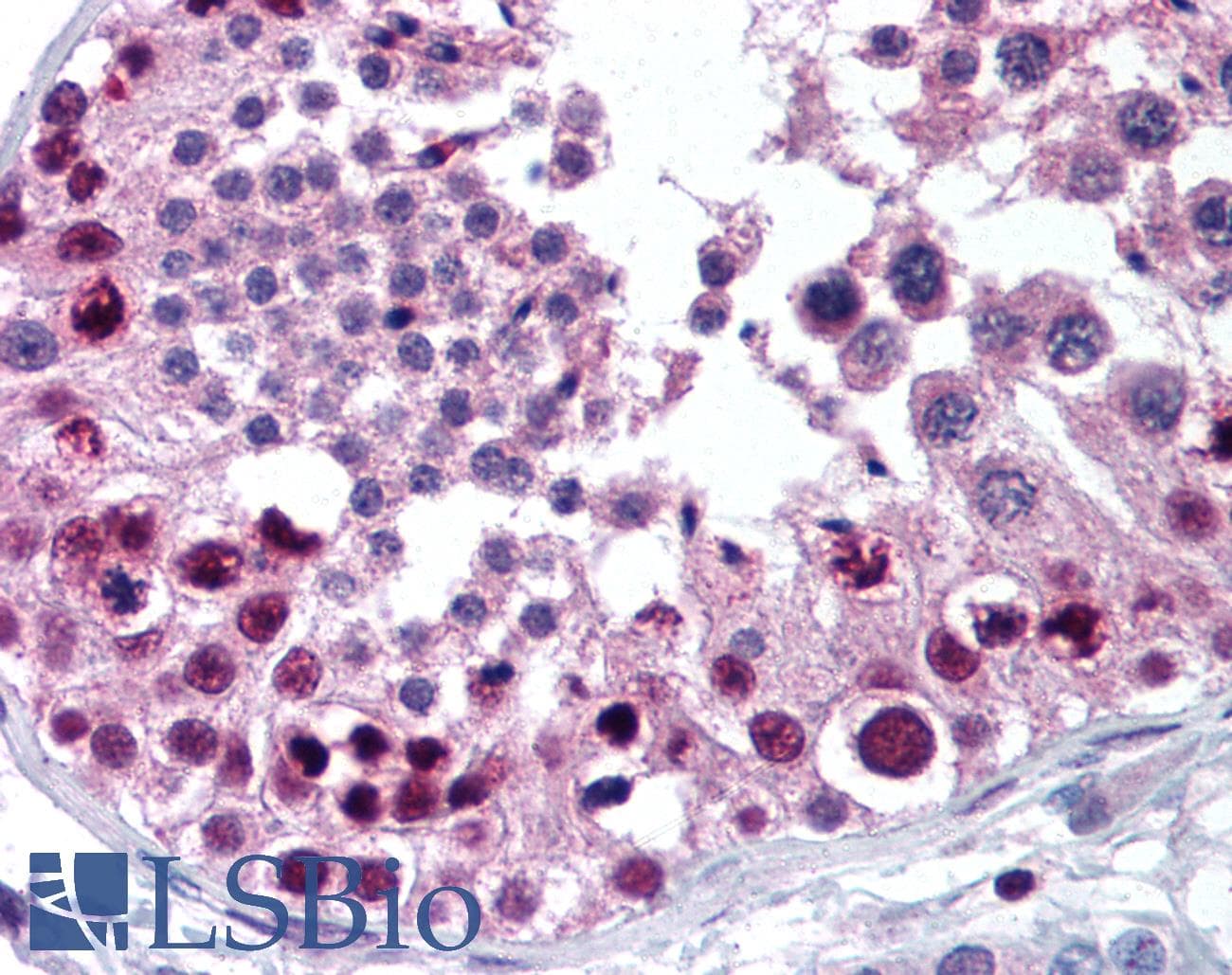 IHC-plus™ Polyclonal Rabbit anti-Human MTA2 Antibody (aa650-700, IHC, WB)