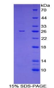 Mouse FKBP38 / FKBP8 Protein (Recombinant His)