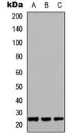 GH / Growth Hormone Antibody (Internal)