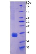 Rat MB / Myoglobin Protein (Recombinant 6His, N-terminus)