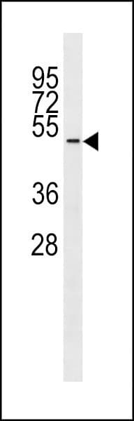 Polyclonal Rabbit anti-Human TUBD1 / Tubulin Delta Antibody (aa366-392, WB)