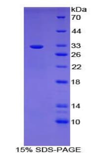 Mouse BCL3 / BCL-3 Protein (Recombinant His-T7)