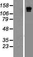 Human LAMC2 / Laminin Gamma 2 Protein (Over-Expression Lysate Myc-DDK (Flag))